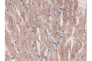 IHC-P analysis of Rat Heart Tissue, with DAB staining. (CS anticorps  (AA 56-312))