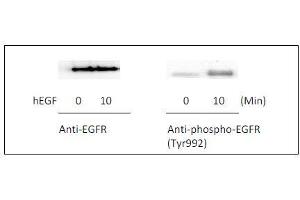 Western blot analysis of extracts from 100 ng/mL hEGF treated A431 cells. (EGFR Kit ELISA)