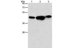Western Blot analysis of 293T, PC3 and NIH/3T3 cell using ARFGAP1 Polyclonal Antibody at dilution of 1:850 (ARFGAP1 anticorps)
