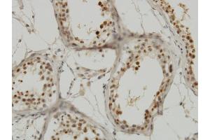 Immunoperoxidase of monoclonal antibody to KPNA1 on formalin-fixed paraffin-embedded human testis.