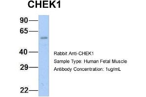 Host: Rabbit Target Name: CHEK1 Sample Type: Human Fetal Muscle Antibody Dilution: 1.