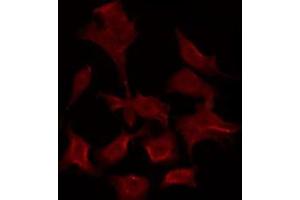ABIN6275914 staining HepG2 by IF/ICC. (Adenosine A3 Receptor anticorps  (C-Term))