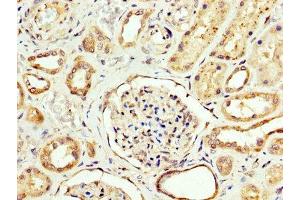 IHC image of ABIN7146841 diluted at 1:200 and staining in paraffin-embedded human kidney tissue performed on a Leica BondTM system. (CPT2 anticorps  (AA 388-551))