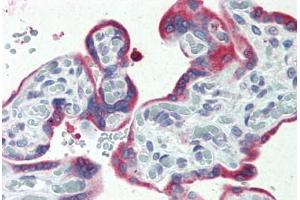 Human, Placenta: Formalin-Fixed Paraffin-Embedded (FFPE) (ERP44 anticorps  (C-Term))