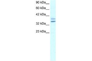 WB Suggested Anti-EHF Antibody Titration: 1. (EHF anticorps  (N-Term))