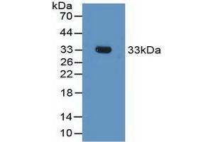 Detection of Recombinant FCN1, Rat using Polyclonal Antibody to Ficolin 1 (FCN1) (FCN1 anticorps  (AA 25-279))