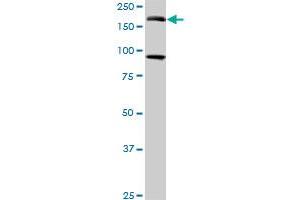 Western Blotting (WB) image for anti-Eukaryotic Translation Initiation Factor 4 gamma 3 (EIF4G3) (AA 1-516) antibody (ABIN599055) (EIF4G3 anticorps  (AA 1-516))