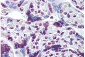 Human Placenta: Formalin-Fixed, Paraffin-Embedded (FFPE) (RBM5 anticorps  (AA 75-184))