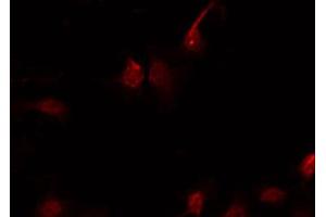 ABIN6267641 staining Hela by IF/ICC.