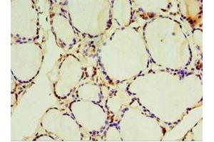 Immunohistochemistry of paraffin-embedded human thyroid tissue using ABIN7170959 at dilution of 1:100 (SULT1C2 anticorps  (AA 1-120))