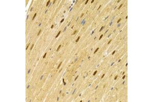 Immunohistochemistry of paraffin-embedded rat heart using CDC25A antibody (ABIN5970519) at dilution of 1/100 (40x lens). (CDC25A anticorps)