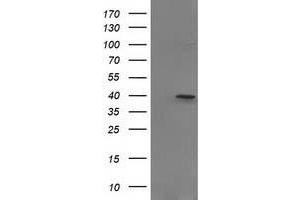 Image no. 1 for anti-PIH1 Domain Containing 2 (PIH1D2) antibody (ABIN1500197)