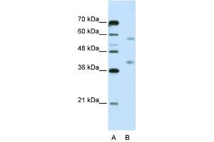WB Suggested Anti-HNRPA3 Antibody Titration:  5. (HNRNPA3 anticorps  (N-Term))