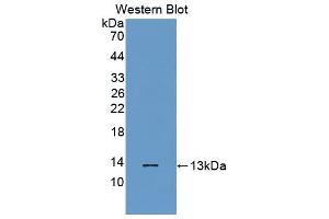 Western blot analysis of the recombinant protein. (Melatonin Receptor 1A anticorps  (AA 296-350))