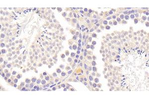 Detection of TIMP2 in Mouse Testis Tissue using Polyclonal Antibody to Tissue Inhibitors Of Metalloproteinase 2 (TIMP2)