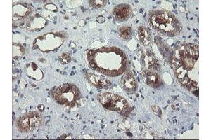 Image no. 2 for anti-Prefoldin Subunit 3 (PFDN3) antibody (ABIN1501705)