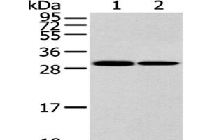 Western Blot analysis of K562 and 293T cell using HNRNPC Polyclonal Antibody at dilution of 1/200 (HNRNPC anticorps)