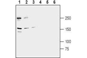 Western blot analysis of human LNCaP prostate carcinoma (lanes 1 and 4), human HeLa cervix carcinoma (lanes 2 and 5) and human HepG2 liver carcinoma (lanes 3 and 6) cell line lysates: - 1-3.