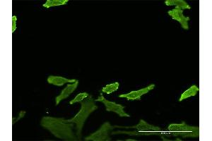 Immunofluorescence of monoclonal antibody to SERPINB1 on HeLa cell.