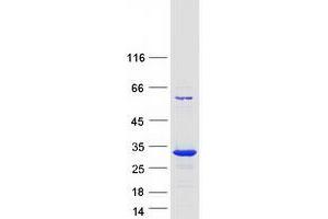 Validation with Western Blot