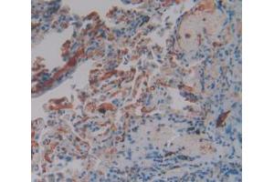 IHC-P analysis of Human Lung Tissue, with DAB staining. (FGG anticorps  (AA 166-416))