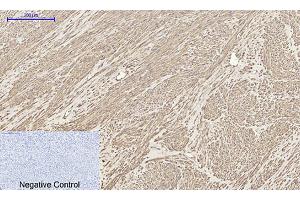Immunohistochemical analysis of paraffin-embedded human uterus tissue.