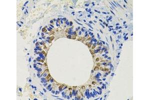 Immunohistochemistry of paraffin-embedded Mouse lung using CALB2 Polyclonal Antibody at dilution of 1:100 (40x lens). (Calretinin anticorps)