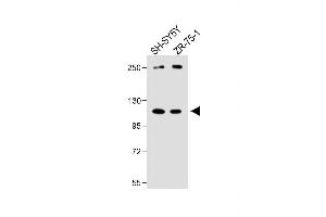 All lanes : Anti-PCDHA8 Antibody (C-term) at 1:1000 dilution Lane 1: SH-SY5Y whole cell lysate Lane 2: ZR-75-1 whole cell lysate Lysates/proteins at 20 μg per lane. (PCDHa8 anticorps  (C-Term))