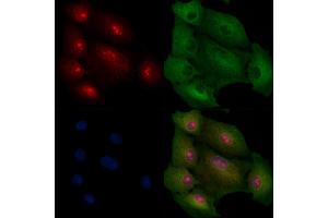 ABIN6257837 and ABIN6275222 staining  cells by IF/ICC. (MED8 anticorps  (C-Term))