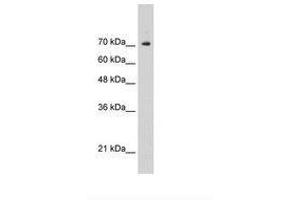 Image no. 1 for anti-Signal Transducer and Activator of Transcription 1, 91kDa (STAT1) (C-Term) antibody (ABIN6736305)