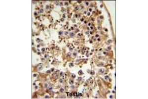 FANCC Antibody (C-term) (ABIN653475 and ABIN2842896) IHC analysis in formalin fixed and paraffin embedded testis tissue followed by peroxidase conjugation of the secondary antibody and DAB staining.
