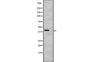 Western blot analysis of TAF7 expression in TAF7 transfected 293T cell lysate,The lane on the left is treated with the antigen-specific peptide. (TAF7 anticorps  (Internal Region))