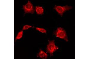 ABIN6268695 staining HepG2 by IF/ICC.