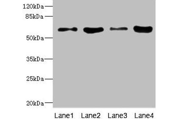 PIP5K1A Antikörper  (AA 293-562)