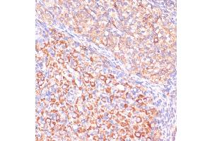 Immunohistochemistry of paraffin-embedded rat ovary using VHL antibody (ABIN3020967, ABIN3020968, ABIN3020969 and ABIN6213828) at dilution of 1:200 (40x lens).