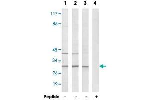 Western blot analysis of extracts from COLO cells (Lane 1), HeLa cells (Lane 2) and HUVEC cells (Lane 3 and lane 4), using RPS4Y1 polyclonal antibody . (RPS4Y1 anticorps  (C-Term))