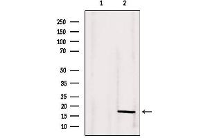 Western blot analysis of extracts from 293, using ANG Antibody. (ANG anticorps  (Internal Region))