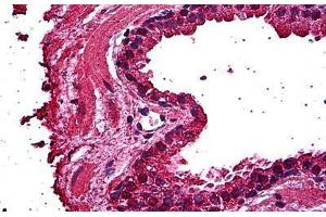 Human Prostate, Epithelium: Formalin-Fixed, Paraffin-Embedded (FFPE) (ERN1 anticorps  (AA 401-500))