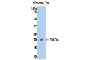 Western Blotting (WB) image for anti-Glycoprotein VI (Platelet) (GP6) (AA 86-231) antibody (ABIN1175188) (GP6 anticorps  (AA 86-231))