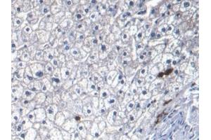 Detection of S100A8 in Human Liver Tissue using Monoclonal Antibody to S100 Calcium Binding Protein A8 (S100A8)
