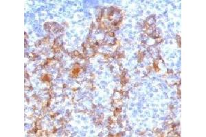 IHC testing of FFPE human tonsil with Acidic Cytokeratin antibody. (Keratin Acidic (AE1) anticorps)