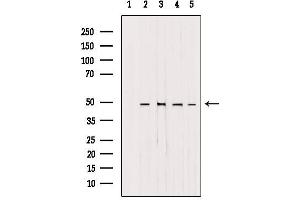 Western blot analysis of extracts from various samples, using AP1M1 antibody. (AP1M1 anticorps  (Internal Region))