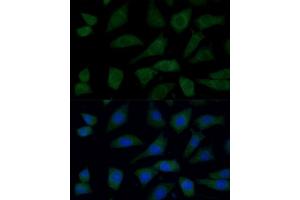 Immunofluorescence analysis of L929 cells using FGD1 Polyclonal Antibody (ABIN7267284) at dilution of 1:100 (40x lens). (FGD1 anticorps  (AA 700-800))