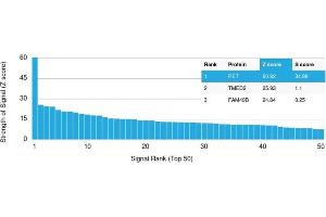 Analysis of Protein Array containing more than 19,000 full-length human proteins using RET Mouse Monoclonal Antibody (RET/2795).