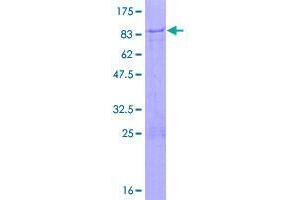 Image no. 1 for Zinc Finger Protein 358 (ZNF358) (AA 1-481) protein (GST tag) (ABIN1326139)
