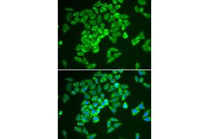 Immunofluorescence analysis of A549 cells using KEAP1 antibody. (KEAP1 anticorps)