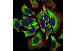 Immunofluorescence analysis of HeLa cells using HAS2 mouse mAb (green). (HAS2 anticorps  (AA 67-170))