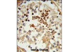 Formalin-fixed and paraffin-embedded human testis tissue reacted with HSL Antibody (C-term), which was peroxidase-conjugated to the secondary antibody, followed by DAB staining. (HSPA4L anticorps  (C-Term))