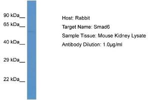 Host: Rabbit Target Name: SMAD6 Sample Tissue: Mouse Kidney Antibody Dilution: 1ug/ml (SMAD6 anticorps  (C-Term))