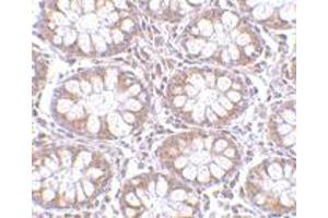 Immunohistochemistry of CD248 in human colon tissue with CD248 polyclonal antibody  at 2. (CD248 anticorps  (C-Term))